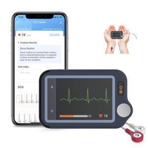 Wearable Checkme ECG Monitors